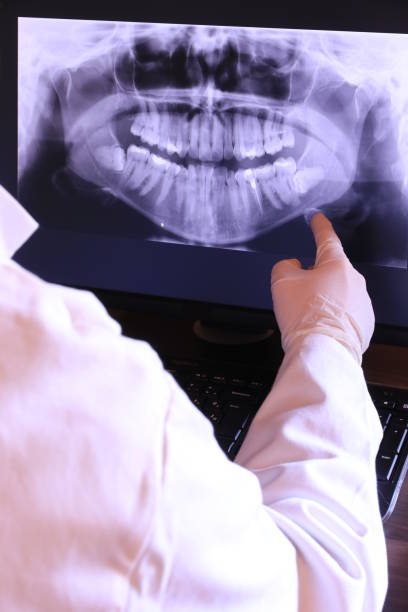 Best Emergency Dentist for Knocked-Out Tooth in Northwest Harwinton, CT