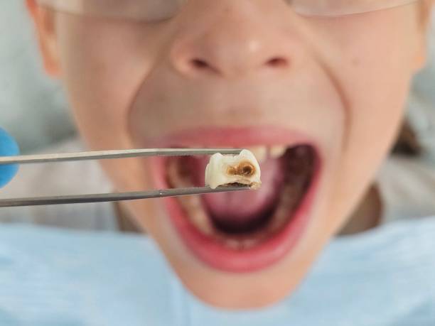 Best Pediatric Emergency Dentist in Northwest Harwinton, CT
